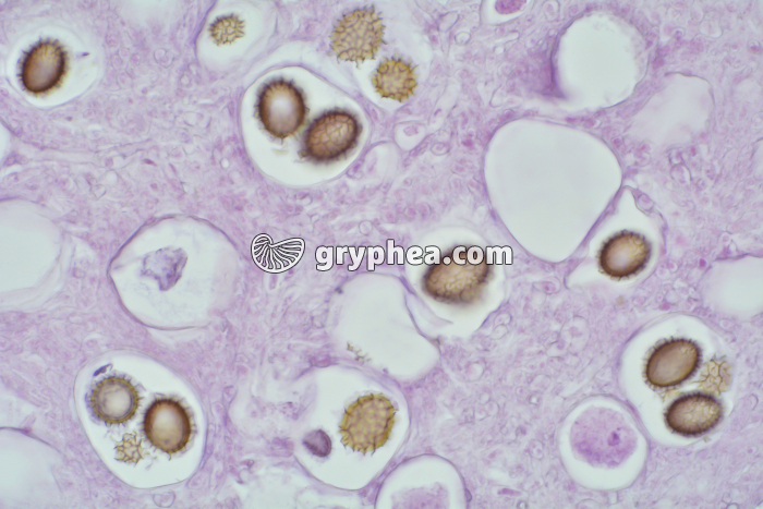 Truffe (Tuber melanosporum) montrant les ascospores CT x100 - gryphea.com